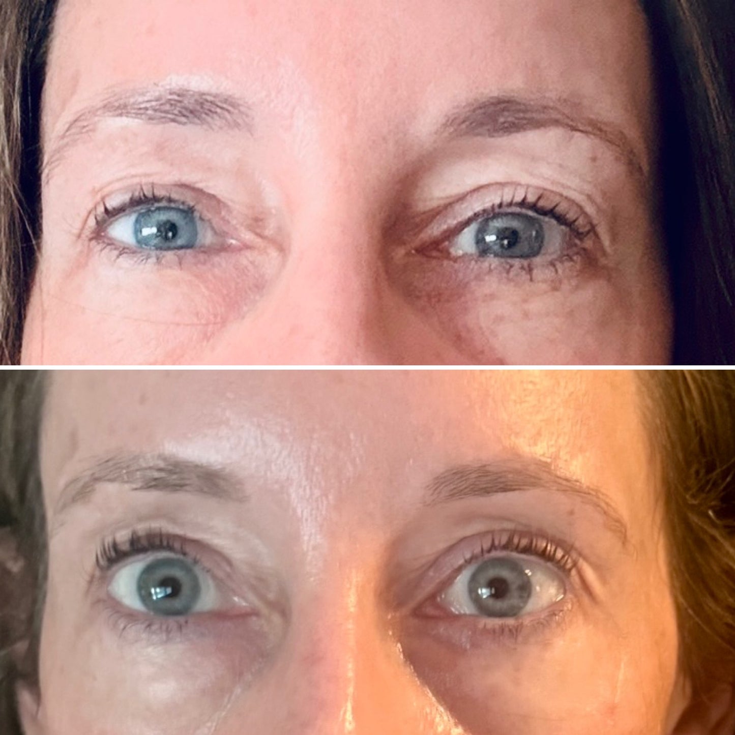 Christmas in July Sale - NeoGen PSR Gel Eyes - Single Session