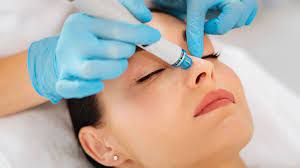 Event - Hydrodermabrasion facial 1 session