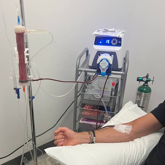 EVENT EBOO Package of 3 Sessions + 1 Complimentary Vitamin IV per session